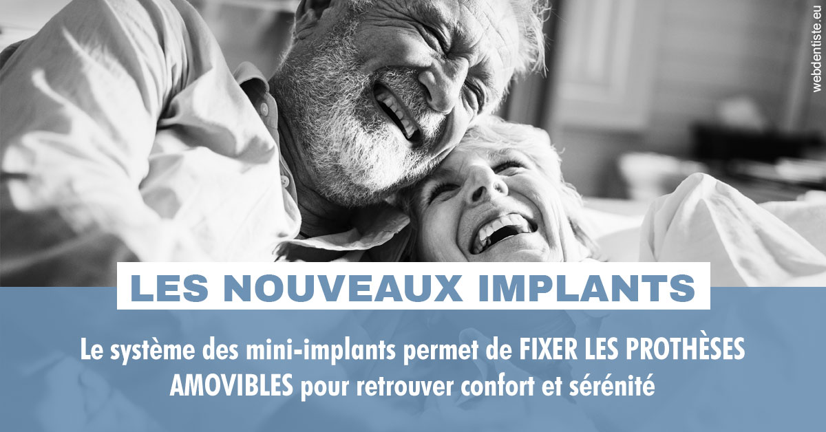 https://dr-marzouk-roland.chirurgiens-dentistes.fr/Les nouveaux implants 2