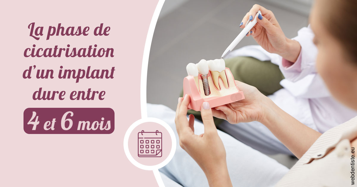 https://dr-marzouk-roland.chirurgiens-dentistes.fr/Cicatrisation implant 2