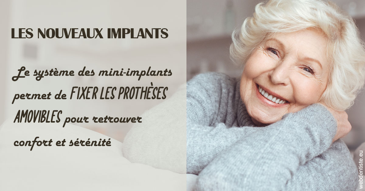 https://dr-marzouk-roland.chirurgiens-dentistes.fr/Les nouveaux implants 1