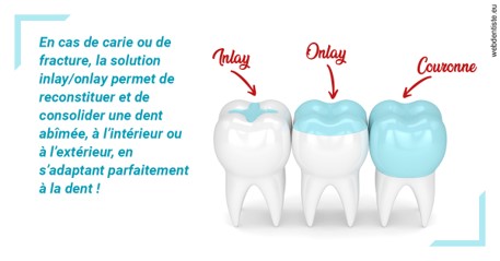 https://dr-marzouk-roland.chirurgiens-dentistes.fr/L'INLAY ou l'ONLAY