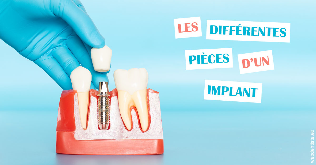 https://dr-marzouk-roland.chirurgiens-dentistes.fr/Les différentes pièces d’un implant 2