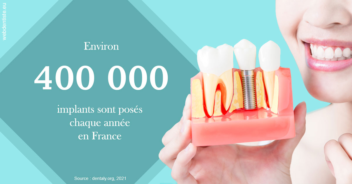 https://dr-marzouk-roland.chirurgiens-dentistes.fr/Pose d'implants en France 2